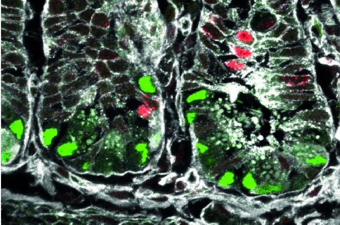 Il s'agit de stimuler la formation de cellules entéroendocrines spécifiques à partir de cellules souches intestinales (en vert sur visuel), qui vont produite les hormones même de régulation de l'appétit, la prise alimentaire, la vidange gastrique et la sécrétion d'insuline par les cellules bêta pancréatiques (Visuel Helmholtz Zentrum München). 